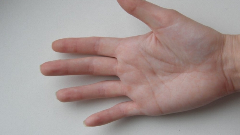 Sursa foto Perkiadmin