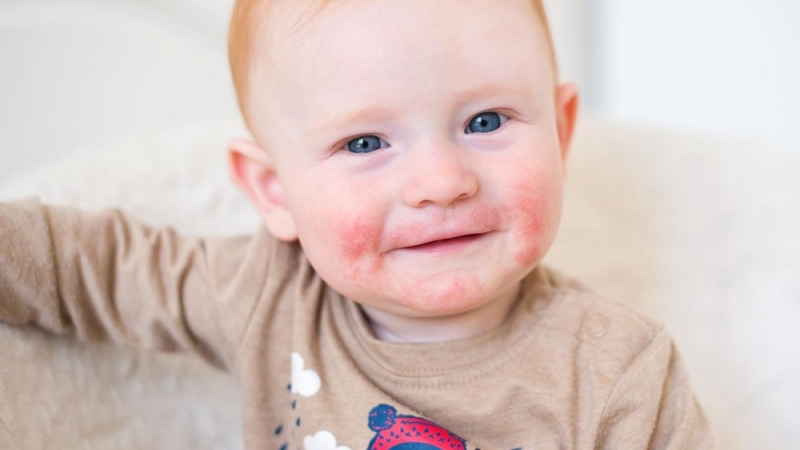 Sursa: Amico Pediatra