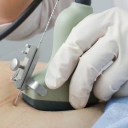 Care sunt riscurile amniocentezei şi când este indicată această analiză