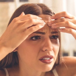 Acneea la adulți poate fi declanșată și de stres