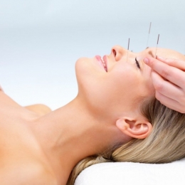 Acupunctura vindecă migrenele sau durerile de dinţi