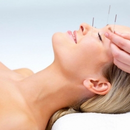 Acupunctura - terapia care vă scapă de dureri