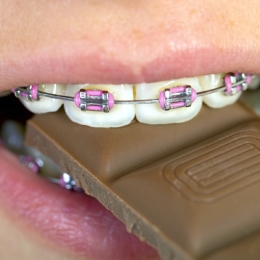 Alimente interzise! Nu le consumaţi dacă purtaţi aparat dentar