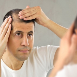 Alopecia poate apărea şi din cauza stresului