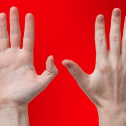 Amorțeala degetelor de la picioare poate anunța Sindromul Morton