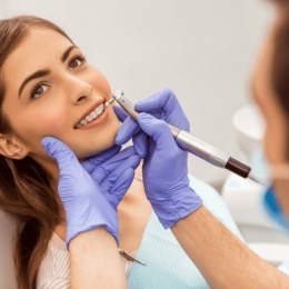 Cum să vă îngrijiți dinții când purtați un aparat dentar