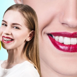 Stomatologie de vacanţă. Purtarea aparatului dentar impune reguli stricte