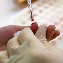 Testările pentru HIV, hepatita virală B sau C, la mare căutare