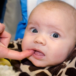Copilul are buza legată? Problema se poate rezolva chirurgical