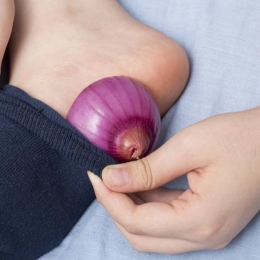 Ceapa, veritabil medicament împotriva picioarelor umflate