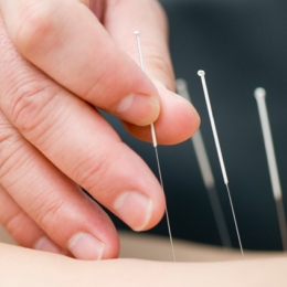 ATENŢIE!  ACUPUNCTURA NU MAI ESTE RECOMANDATĂ