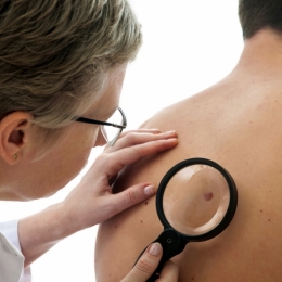 Care sunt principalii factori ce pot cauza cancer de piele