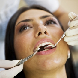 Care sunt beneficiile faţetelor dentare