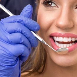 Vreţi dinţi mai albi? Aveţi nevoie de faţete dentare