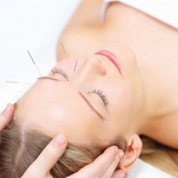 Acupunctura, aliatul principal împotriva durerii
