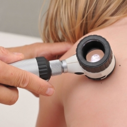 Copilul are multe aluniţe? Când trebuie să devină acestea un motiv de îngrijorare