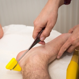 Neuropatia diabetică, o complicaţie severă ce poate duce la amputare