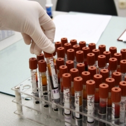 Testul Imunopro 300, una dintre cele mai precise metode de diagnostic