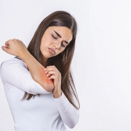 Urticaria se poate ameliora şi cu ajutorul tratamentelor naturiste