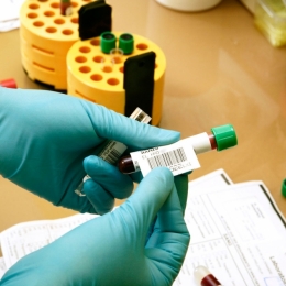 Cât de costisitoare sunt analizele pentru depistarea hepatitei