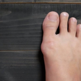 Atenție la încălțămintea pe care o purtați! Monturile pot fi dureroase