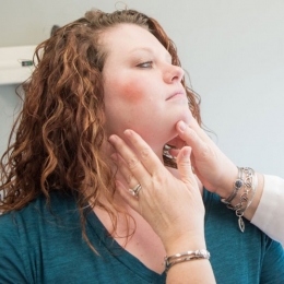 Pielea reactivă este mai des întâlnită la femei