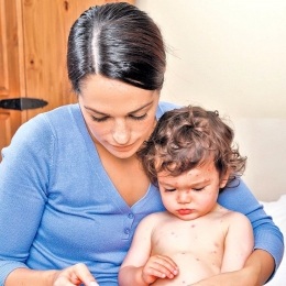 Scarlatina, o boală foarte contagioasă, dar care poate fi tratată şi la domiciliu