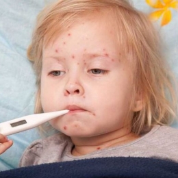 Sfaturi pentru prevenirea răspândirii rujeolei