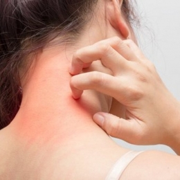 Stresul vă poate umple corpul de eczeme