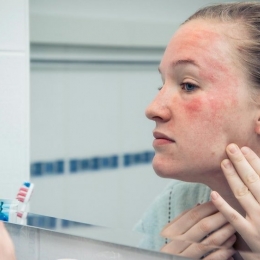 Remedii naturale care țin țânțarii la distanță