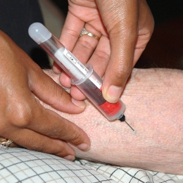 Testări la preţ redus în Constanţa pentru depistarea hepatitei C