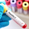 Adulții și copiii cu hepatită C din Constanța beneficiază de tratament fără interferon