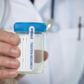 O simplă analiză de urină poate fi salvatoare