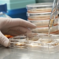Existenţa celulelor stem canceroase, confirmată