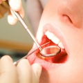 Află cum se tratează boala gingivală