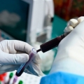 Pacienții care s-au vindecat de COVID-19 pot ajuta la salvarea de vieți