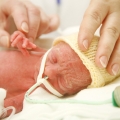 Provocarea de a menţine în viaţă un nou-născut de 600 de grame