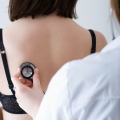 Atenţie, tuberculoza poate fi înşelătoare. Cum se depistează boala