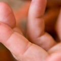 Hemofilia apare când există o deficienţă a factorilor de coagulare