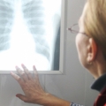 La ce complicaţii poate duce pneumonia netratată