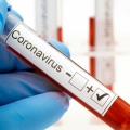 La ce ajută testele de detecție ale anticorpilor împotriva SARS-CoV-2