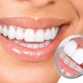 Zece obiceiuri obligatorii pentru dinţi sănătoşi