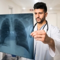 Nu produce simptome clare, dar afectează puternic plămânii