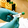 Constănţenii se pot testa şi retesta gratuit, pentru hepatită şi HIV