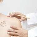 Semnele alarmante în detecţia celui mai frecvent cancer de piele