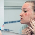 Remedii naturale care țin țânțarii la distanță