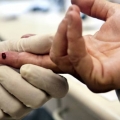 Testare gratuită pentru hepatită şi HIV, până la sfârşitul anului