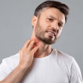Atunci când este frig, urticaria poate determina scăderea tensiunii arteriale